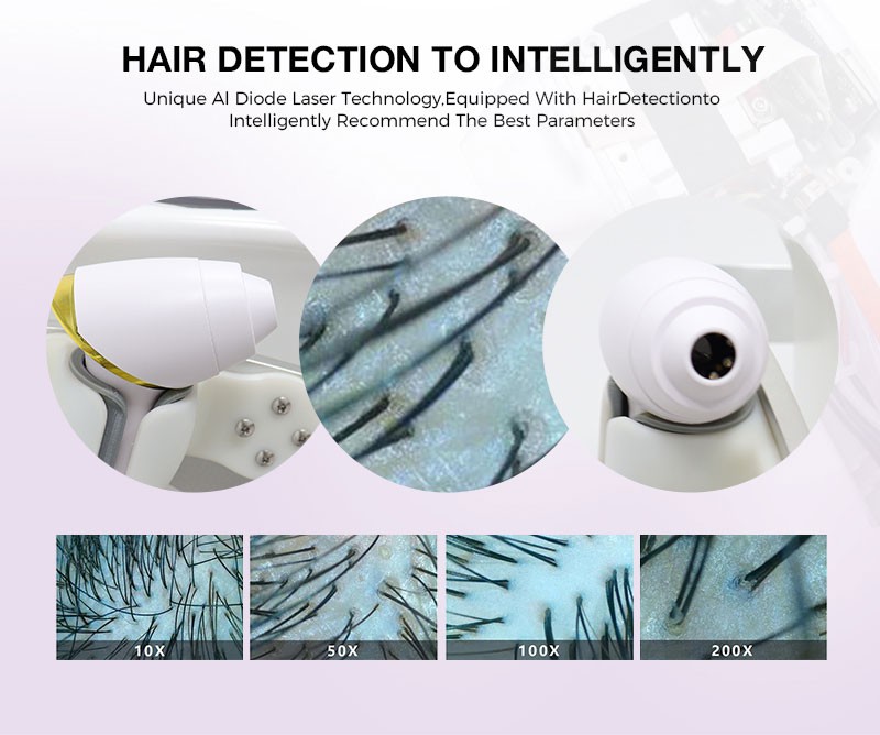 diode laser hair removal machine Middle East diode laser hair removal machine Middle East